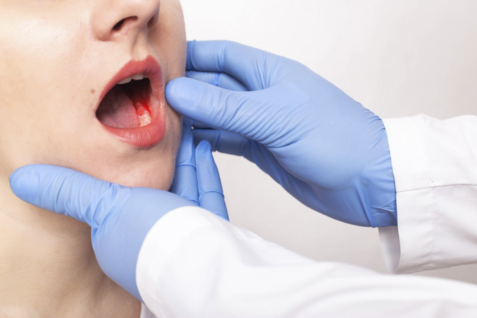 Dentista revisa encías inflamadas