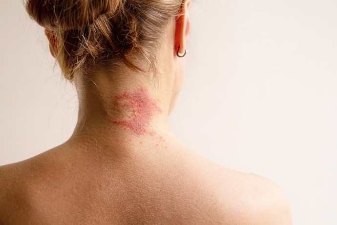 mujer con cuello con puntos rojos