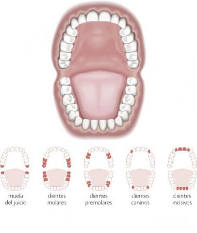 Extraccion De Muelas Del Juicio Y Cuidados Posteriores Bupa